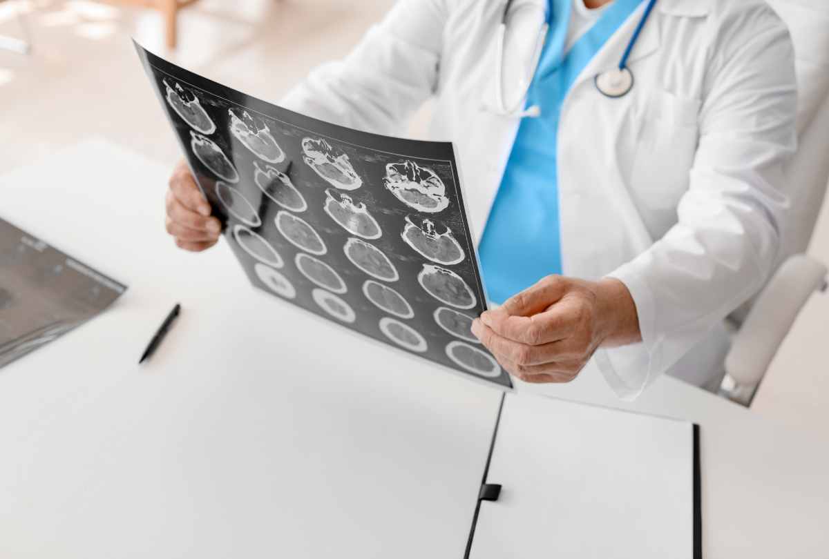 This image shows a medical professional, likely a doctor or neurologist, examining brain CT (computed tomography) scans.